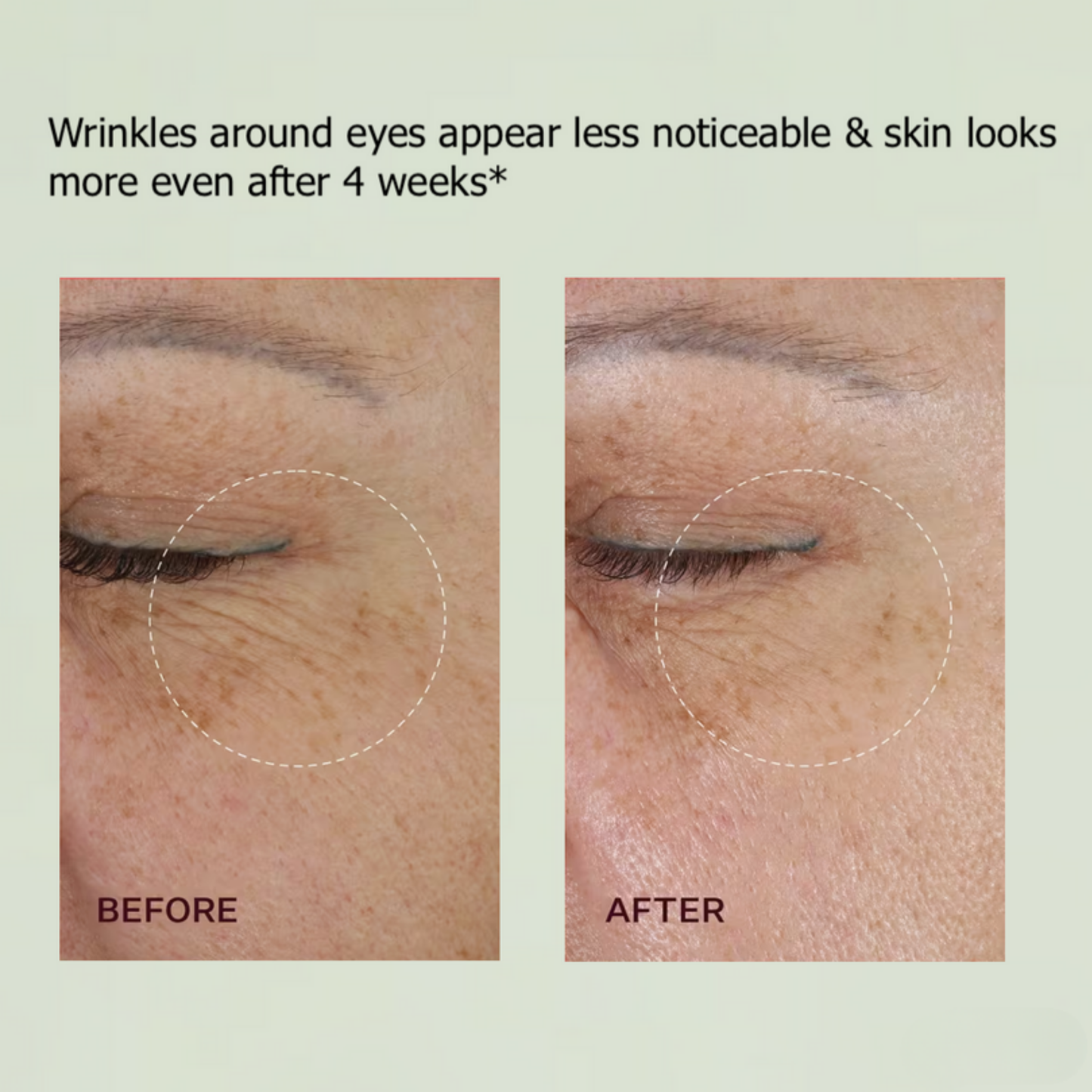 Tightening Booster Retinal Shot